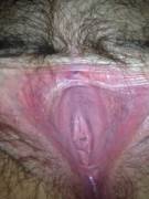 Open wide and say ahhhhh