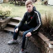 Before & After (x-post /r/Scally)