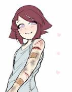 Cuts, bruises [Light][m]