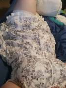 I've had this dress [f]or over a year, and this is the first time I've been able to comfortably zip it.