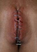 Anyone got a staple extractor?