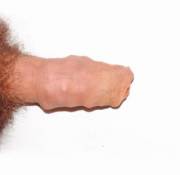 Cheetos is the new smegma