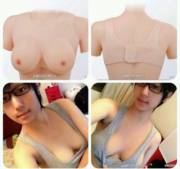 Pfft, who needs surgery?