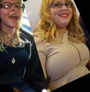 I gained a little weight in my face...