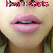 Put some lip gloss on. It's no big deal!