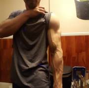 I think there's something wrong with my arm...