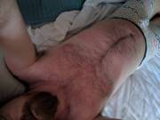 Happy National White People Are Sunburned Day!!