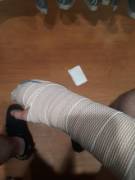 Broke my hand at the TERROR show last night. Awesome pit.