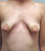 This makes me sad, it looks like a clinical shot just before 