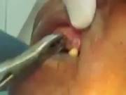 Rotten Gum [NSFWhen Eating]