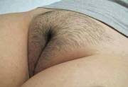 Hairy-mound