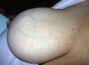 COLLAPSING ... r/thicknipples