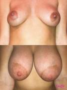 This is how much mine have grown in about 10 months due to pregnancy