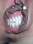 Dentures? Sure, why not! (Cross-post from WTF)