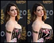 Anne Hathaway Infected with the Bimbo Virus