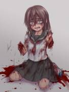 Despair of Amputation