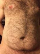 Do I qualify as insanely hairy?