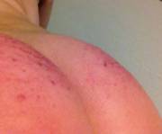 My first spanking pics