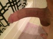 I hate being circumcised :-/