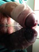 Mine's curved downward :P