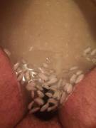 25 days in. I was whining a lot so he made me ice it down.