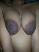 Big dark areolas