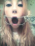 Dental gag